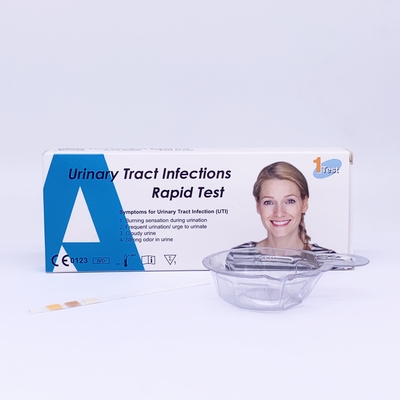 1 minieme Biochemiereagentia, de Teststroken U031-04H van de Urinebesmetting